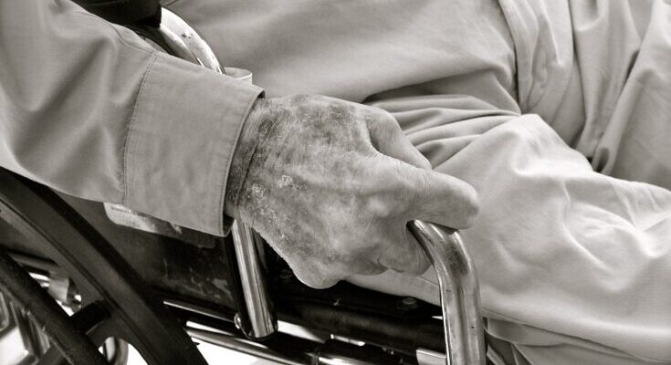 Aging