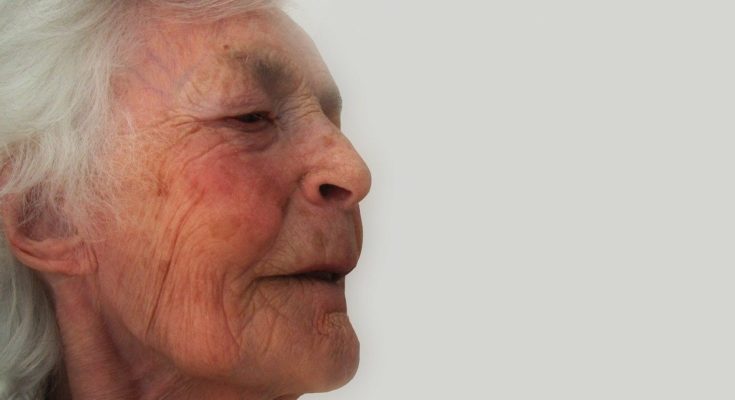 Dementia, Alzheimer's