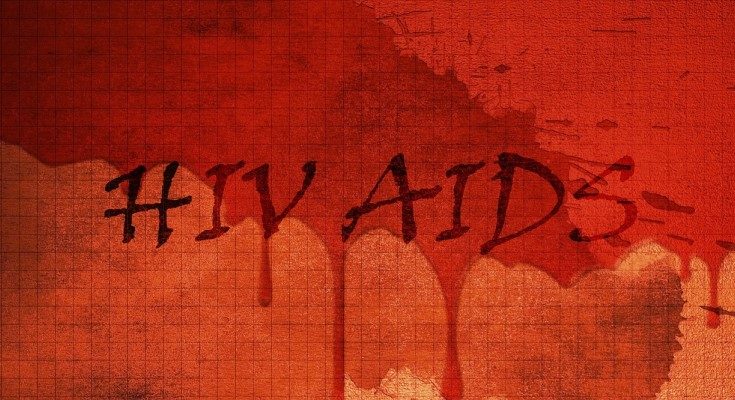 HIV/AIDS